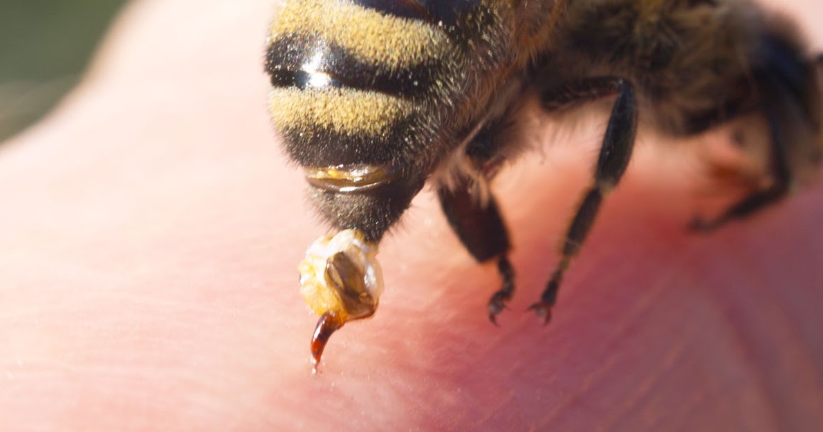 Пчела оставляет жало. Апитоксин яд пчелы.