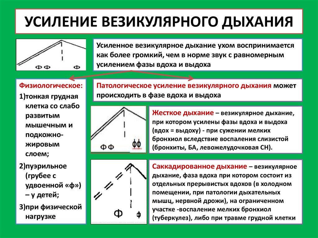 Что такое усиление