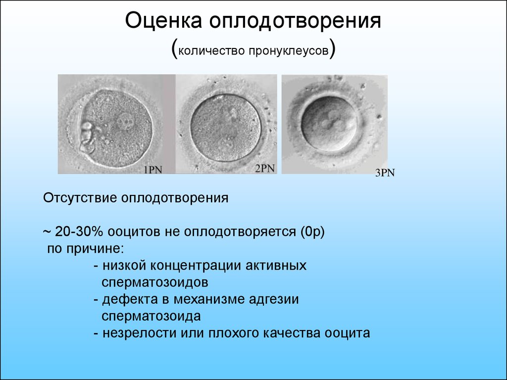 Ооциты качество. Оценка оплодотворения. Оценка качества ооцитов. Что такое ооциты при эко. Плохое качество яйцеклеток.