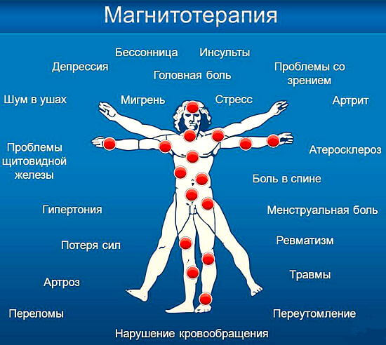 показания для магнитотерапии